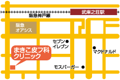 尼崎市の皮膚科 お肌の悩みなら武庫之荘のまきこ皮フ科クリニック